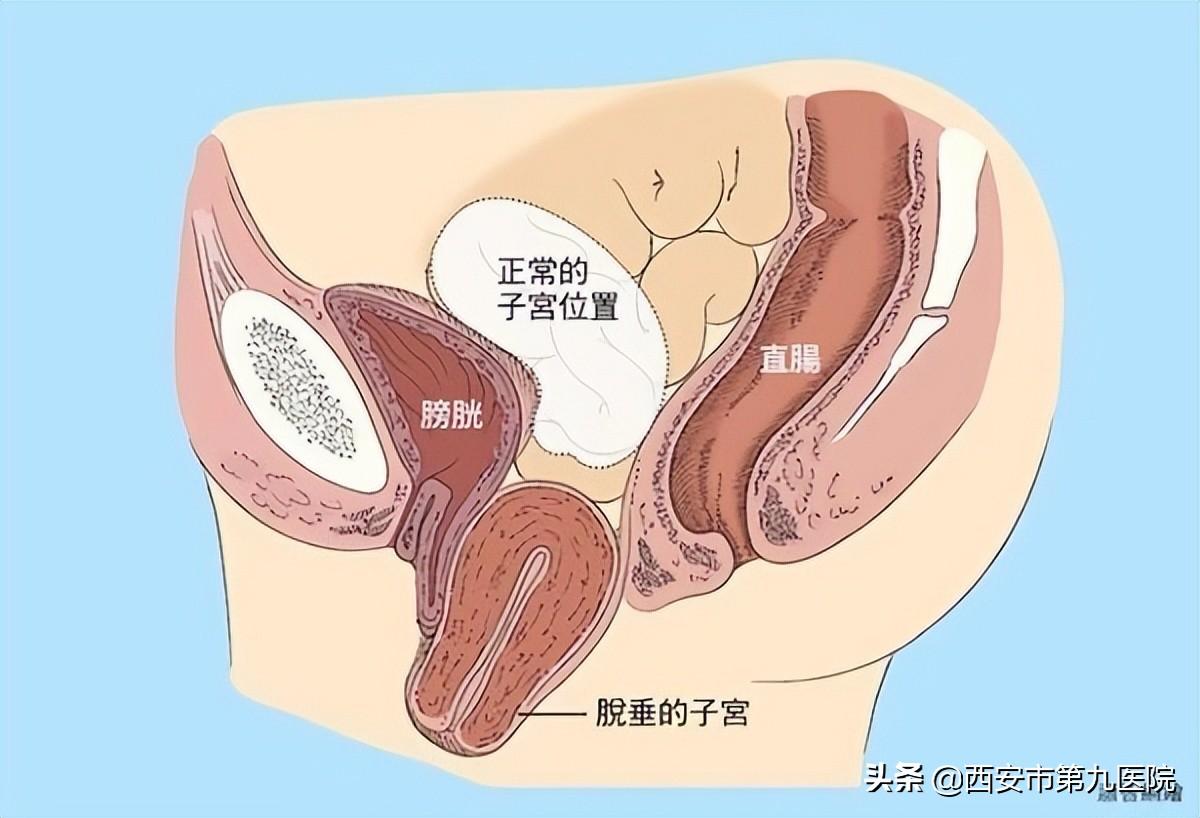 或者可以簡(jiǎn)化為 第3頁(yè)