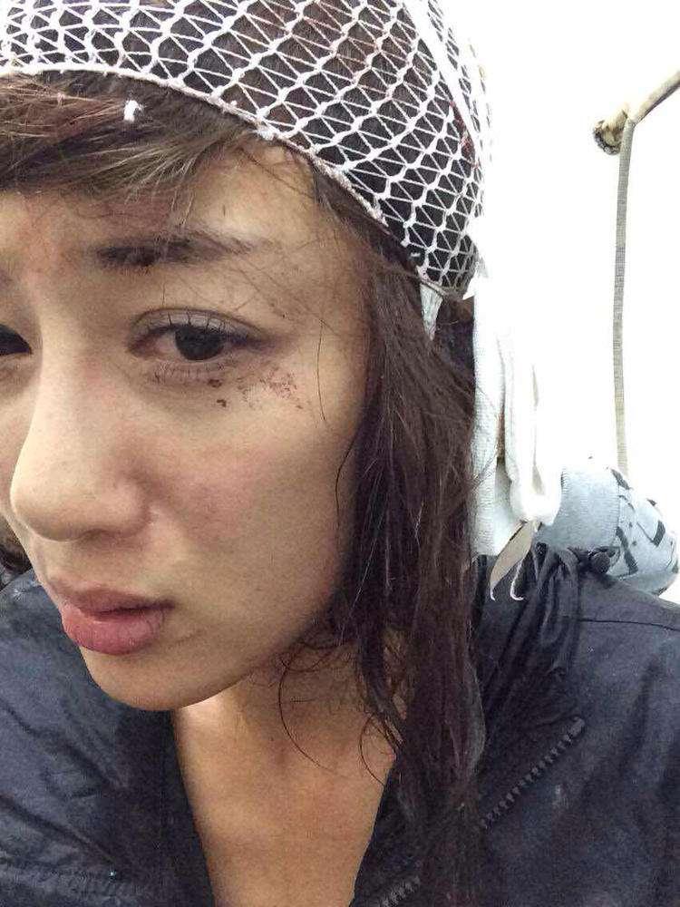 明星整容毀容最嚴重的是誰，深度探討與反思，深度探討與反思，哪位明星整容遭遇最慘重的毀容？