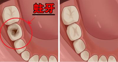 智齒，口腔健康的關(guān)鍵要素與智齒SEO的重要性，智齒，口腔健康的關(guān)鍵與SEO優(yōu)化的重要性