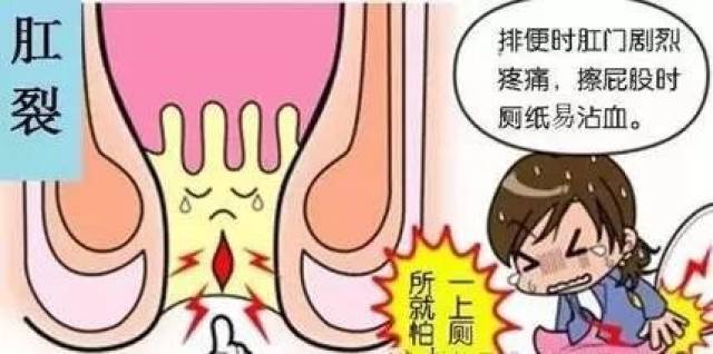 肛裂怎么快速愈合，藥物治療與護理建議，肛裂快速愈合方法，藥物治療與護理建議攻略
