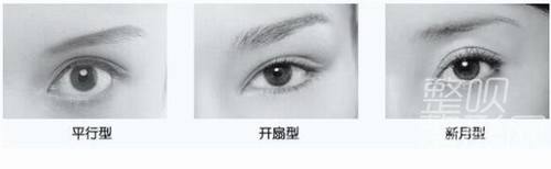 平扇與開扇雙眼皮，哪種更適合你？哪個更好看？，雙眼皮手術(shù)，平扇與開扇風(fēng)格的選擇與美觀度探討