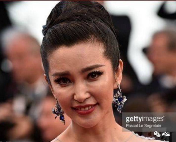 激光去眼袋能維持幾年，全面解析與你的期望相匹配，激光去眼袋效果能維持多久？全面解析滿足你的期望