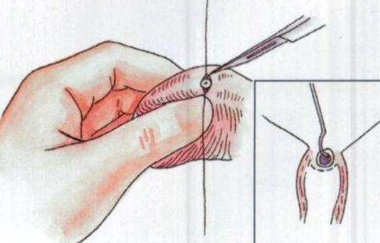 推薦