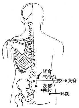 坐骨神經(jīng)痛的治療方法，哪種方式能最快緩解你的疼痛？，坐骨神經(jīng)痛快速緩解方法與治療方式探討