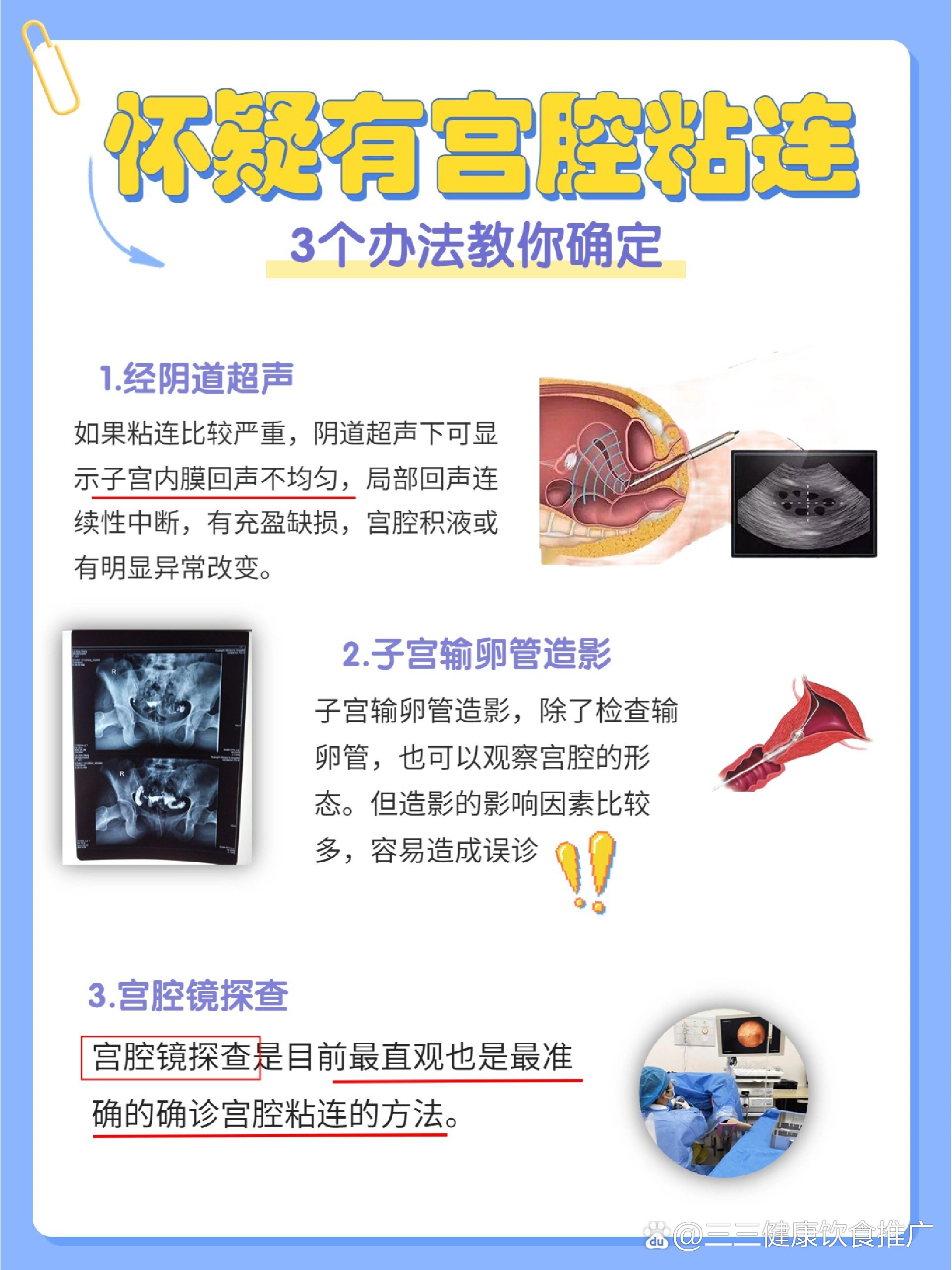 宮腔粘連自檢方法及其重要性，宮腔粘連自檢方法及其重要性解析