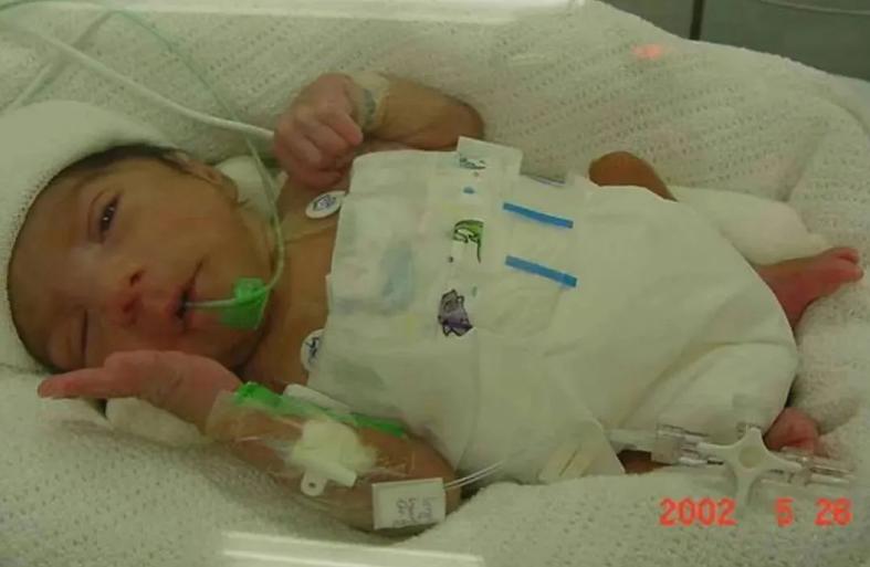 萎縮性胃炎患者的壽命預期，了解、管理與展望，萎縮性胃炎患者的壽命預期，理解、管理與未來展望