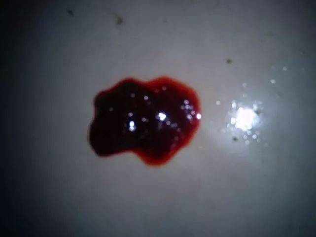 排便時(shí)出現(xiàn)撕裂感及出血，原因與應(yīng)對(duì)措施，排便疼痛撕裂感及出血，原因分析及應(yīng)對(duì)方法