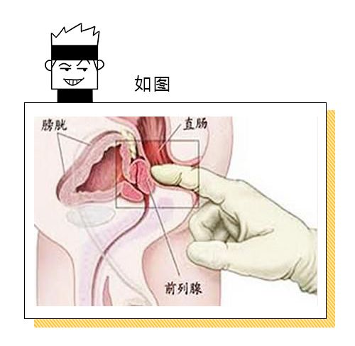 前列腺按摩手法與位置指南，全面解析與實踐，前列腺按摩手法與位置指南，全面解析與實踐技巧
