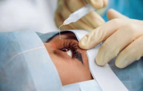 做近視眼手術(shù)的危害，全面解析與深度探討，全面解析與深度探討，近視眼手術(shù)的危害及風(fēng)險(xiǎn)分析