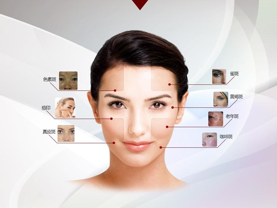 激光祛斑，一次能否徹底去除斑點？，激光祛斑能否一次徹底去除斑點？