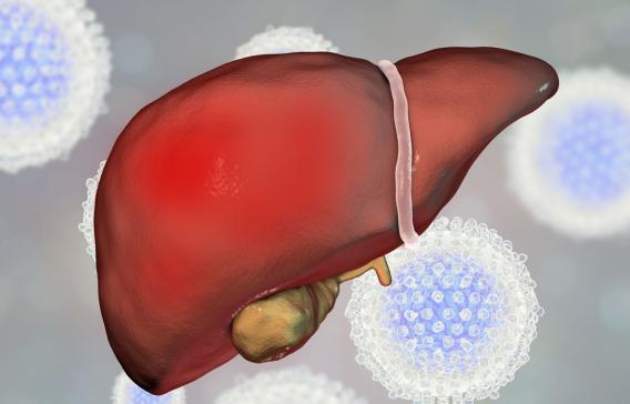 肝硬化的癥狀及表現(xiàn)，肝硬化的癥狀與表現(xiàn)概述
