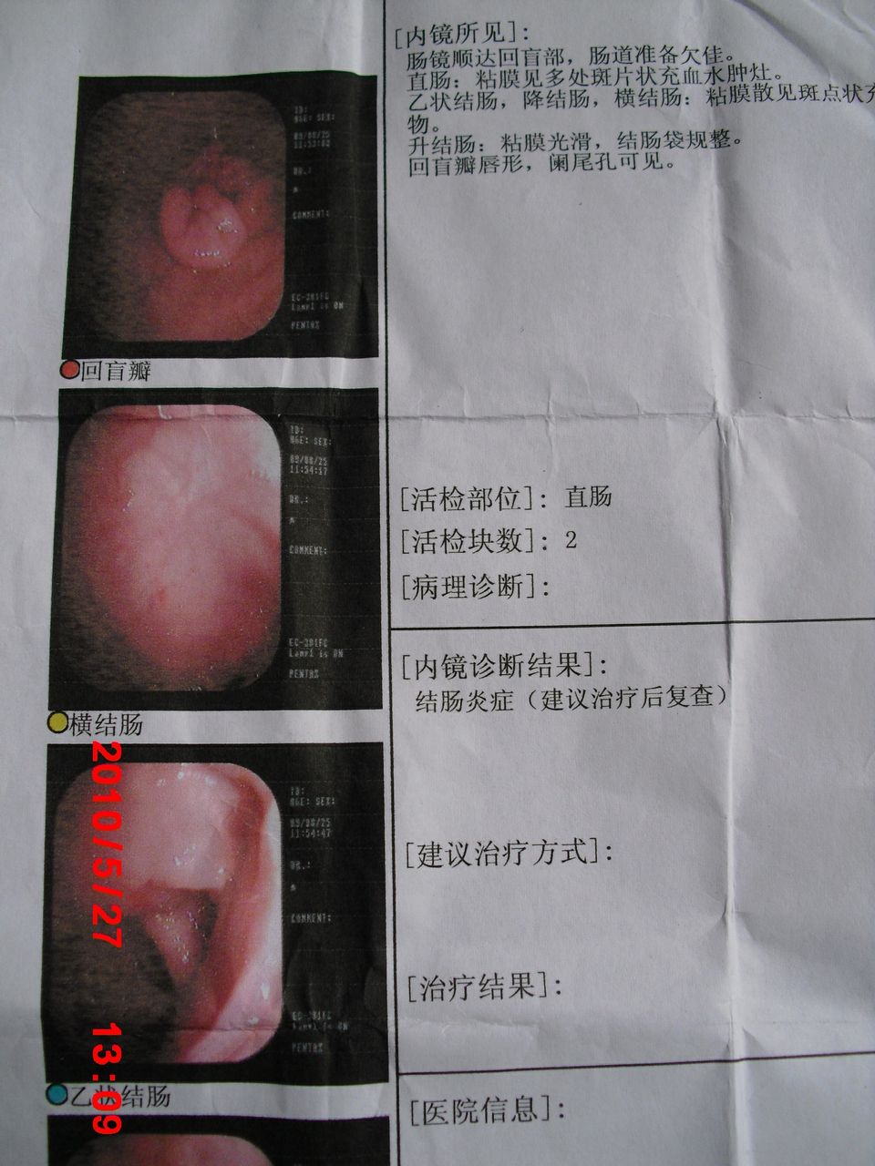 結(jié)腸炎患者應(yīng)該吃什么藥？全面解析治療方案，結(jié)腸炎患者全面解析治療方案，藥物治療指南