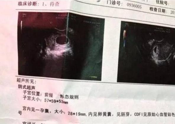 懷孕三個(gè)月自測(cè)男女，了解胎兒性別預(yù)測(cè)方法及注意事項(xiàng)，懷孕三個(gè)月胎兒性別預(yù)測(cè)方法及注意事項(xiàng)，自測(cè)男女須知