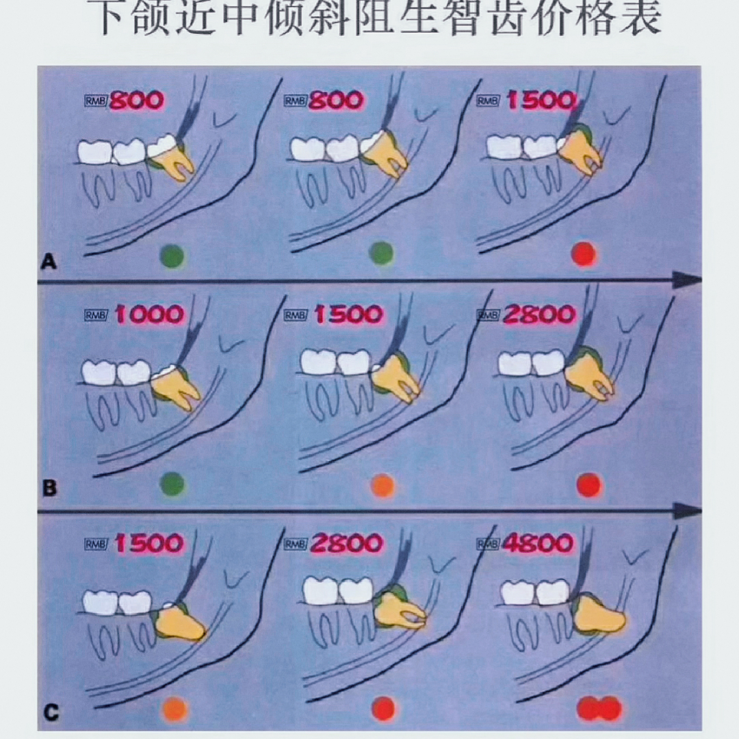 拔智齒收費標準的全面解析，拔智齒收費標準的深度解析與探討