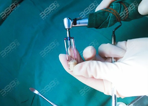 正規(guī)醫(yī)院拔智齒收費標準詳解，正規(guī)醫(yī)院拔智齒的收費標準詳解