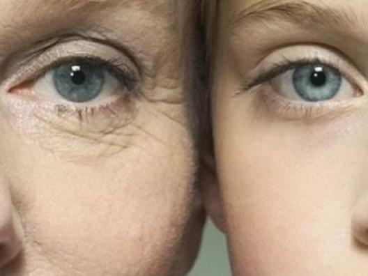 眼紋去除最佳方法，全面解析有效策略，眼紋去除秘訣大揭秘，全面解析最佳方法與有效策略