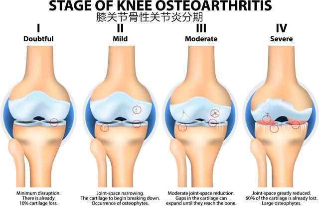 膝關節(jié)疼痛的十大原因及其應對方法，膝關節(jié)疼痛的成因與應對方法解析，十大常見原因及應對策略