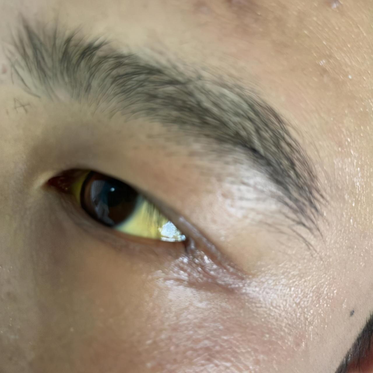 肝功能正常值參考表及其重要性，肝功能正常值參考表，揭示肝臟健康的關(guān)鍵指標及其重要性