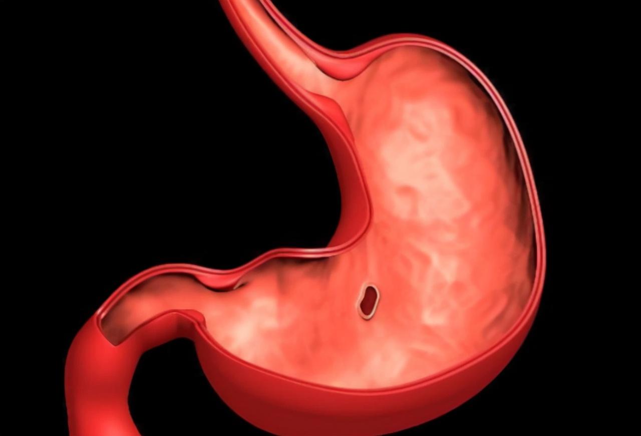 做胃鏡對(duì)胃?jìng)τ卸啻?，深入了解與關(guān)注，胃鏡對(duì)胃的影響，深入了解與關(guān)注