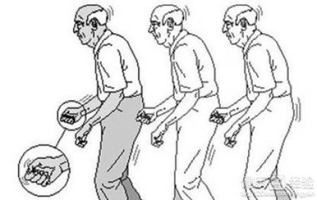 帕金森病的癥狀，深入了解與應(yīng)對，帕金森病癥狀詳解及應(yīng)對策略