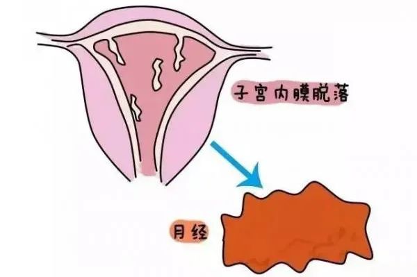 子宮內(nèi)膜增厚能自愈嗎？解析與探討，子宮內(nèi)膜增厚能否自愈？深度解析與探討