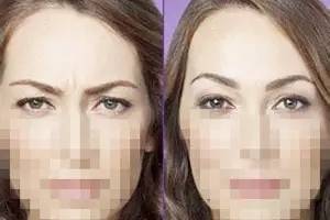 額頭千萬不能打除皺針，了解風(fēng)險(xiǎn)與后果，做出明智選擇，額頭除皺針的風(fēng)險(xiǎn)與后果，明智選擇需了解的內(nèi)容