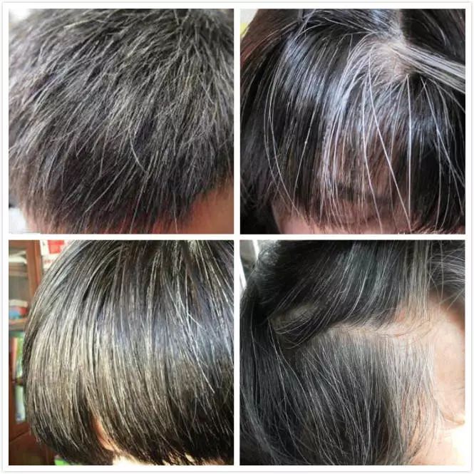 葉酸能讓白頭發(fā)變黑嗎，探究真相與科學解析，葉酸能否讓白頭發(fā)變黑？真相與科學解析探究