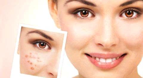 臉上長斑的原因及其影響因素，深度解析，深度解析，臉上長斑的原因及其影響因素