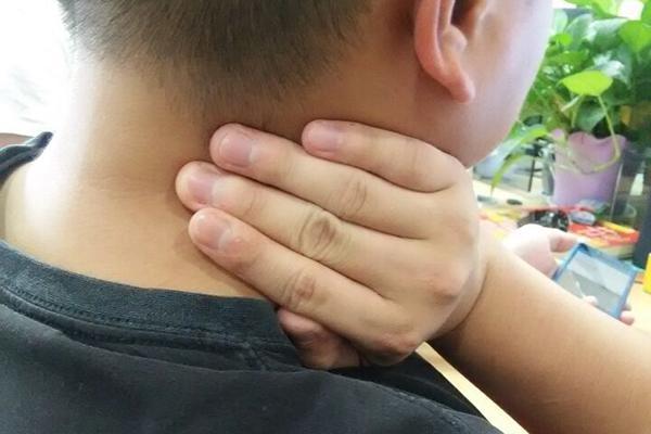 女性甲狀腺早期脖子圖片及其相關(guān)知識與識別，女性甲狀腺早期脖子癥狀圖片及識別與相關(guān)知識