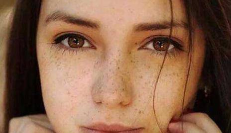 如何淡化臉上的斑，多種方法助你擁有無(wú)瑕肌膚，多種方法助你淡化臉部斑點(diǎn)，重塑無(wú)瑕肌膚