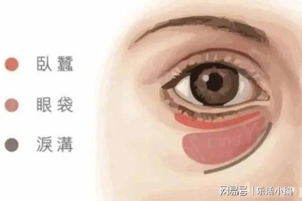 眼袋切除手術(shù)費用詳解，價格因素與如何選擇合適的手術(shù)方案，眼袋切除手術(shù)費用解析，了解價格因素與選擇最佳手術(shù)方案