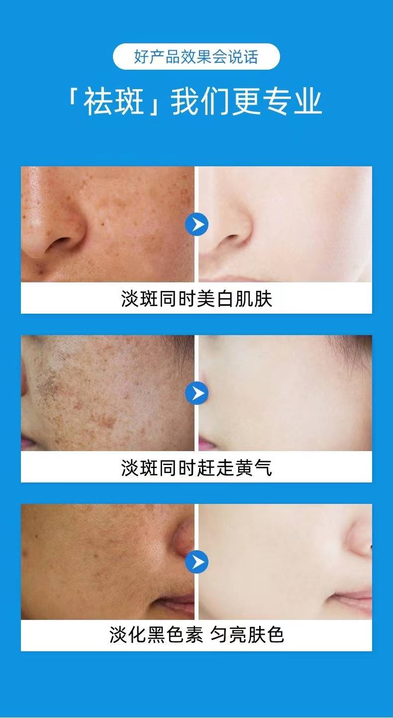 揭秘祛斑最佳方法，如何達(dá)到最佳祛斑效果？，揭秘最佳祛斑方法，實(shí)現(xiàn)最佳效果的秘訣！