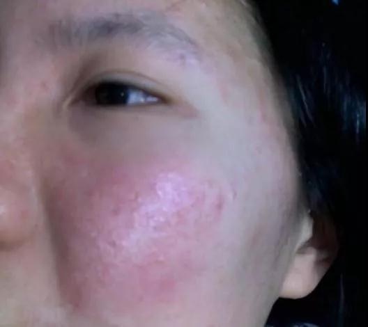 保養(yǎng)皮膚的最好方法，保養(yǎng)皮膚的最佳方法