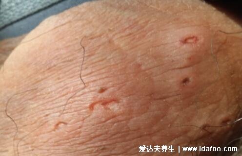 得性疾病前兆，了解、預(yù)防與應(yīng)對(duì)，得性疾病的早期信號(hào)，了解、預(yù)防與應(yīng)對(duì)策略