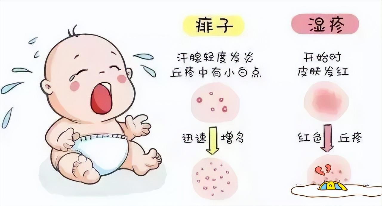 痱子和濕疹的區(qū)別，深入了解兩種常見(jiàn)皮膚狀況，痱子和濕疹的區(qū)別，常見(jiàn)皮膚狀況詳解